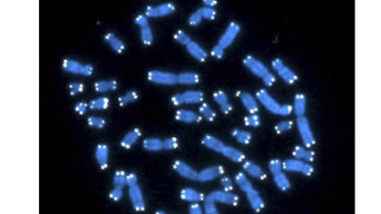 The 46 human chromosomes, where DNA resides and does its work